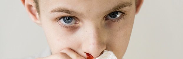 Sangue dal naso (epistassi): cause e rimedi